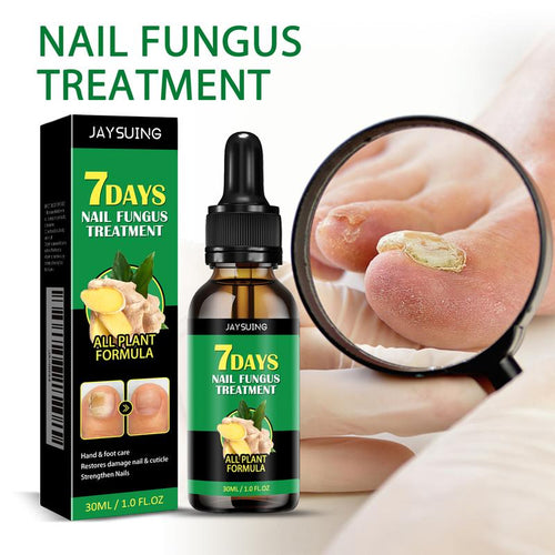 2025-Best Seller-LOVILDS™ Ginger Nail Treatment with Vitamin E & Essential Oils
