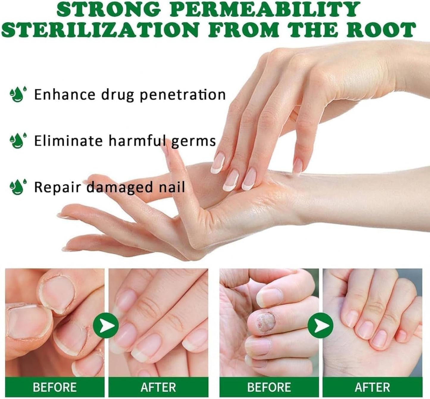 2025-Best Seller-LOVILDS™ Ginger Nail Treatment with Vitamin E & Essential Oils