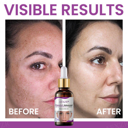 AEXZR® MelantaX Advanced Anti-Hyperpigmentation Essence