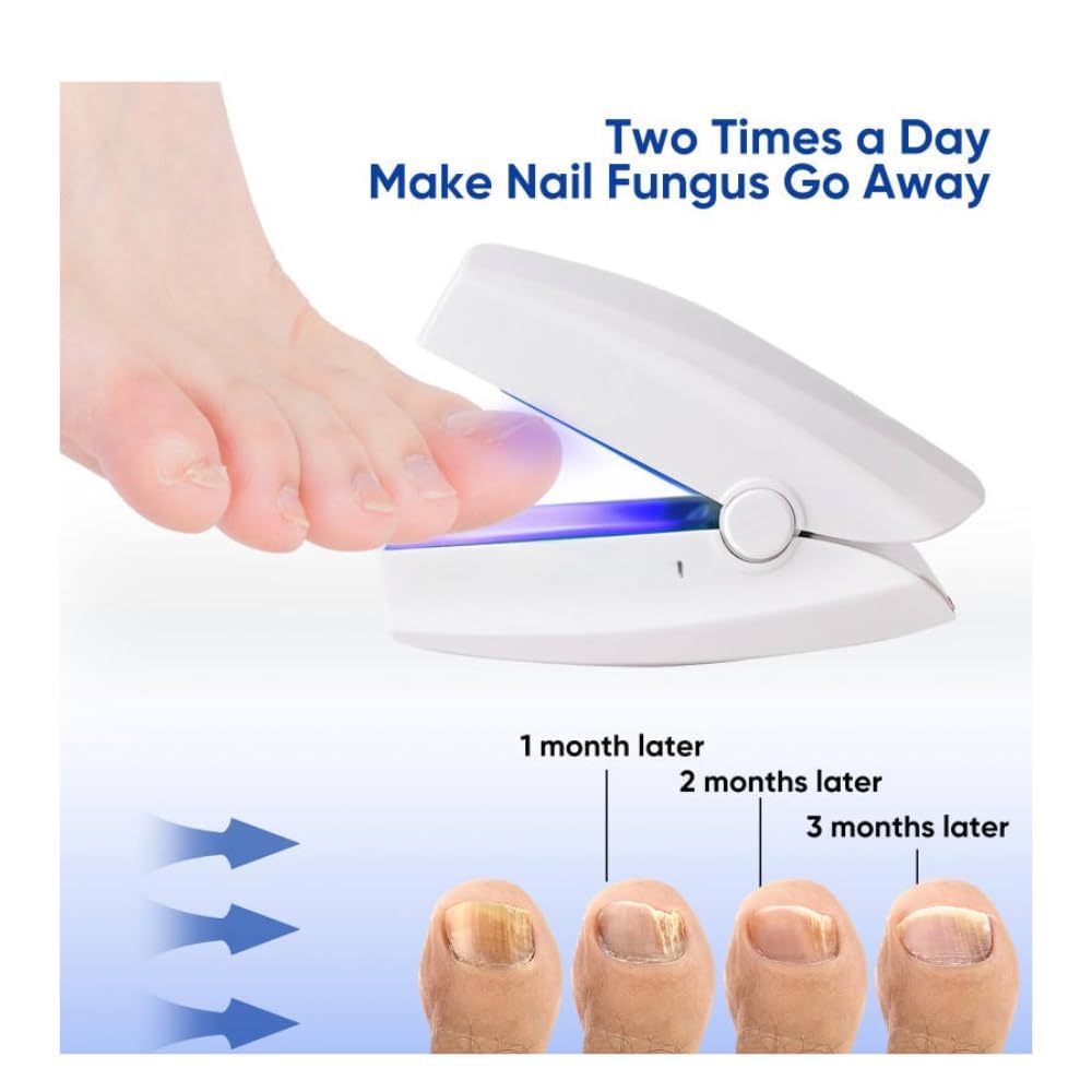 NailHeal Pro™ – Nail Fungus Treatment Device