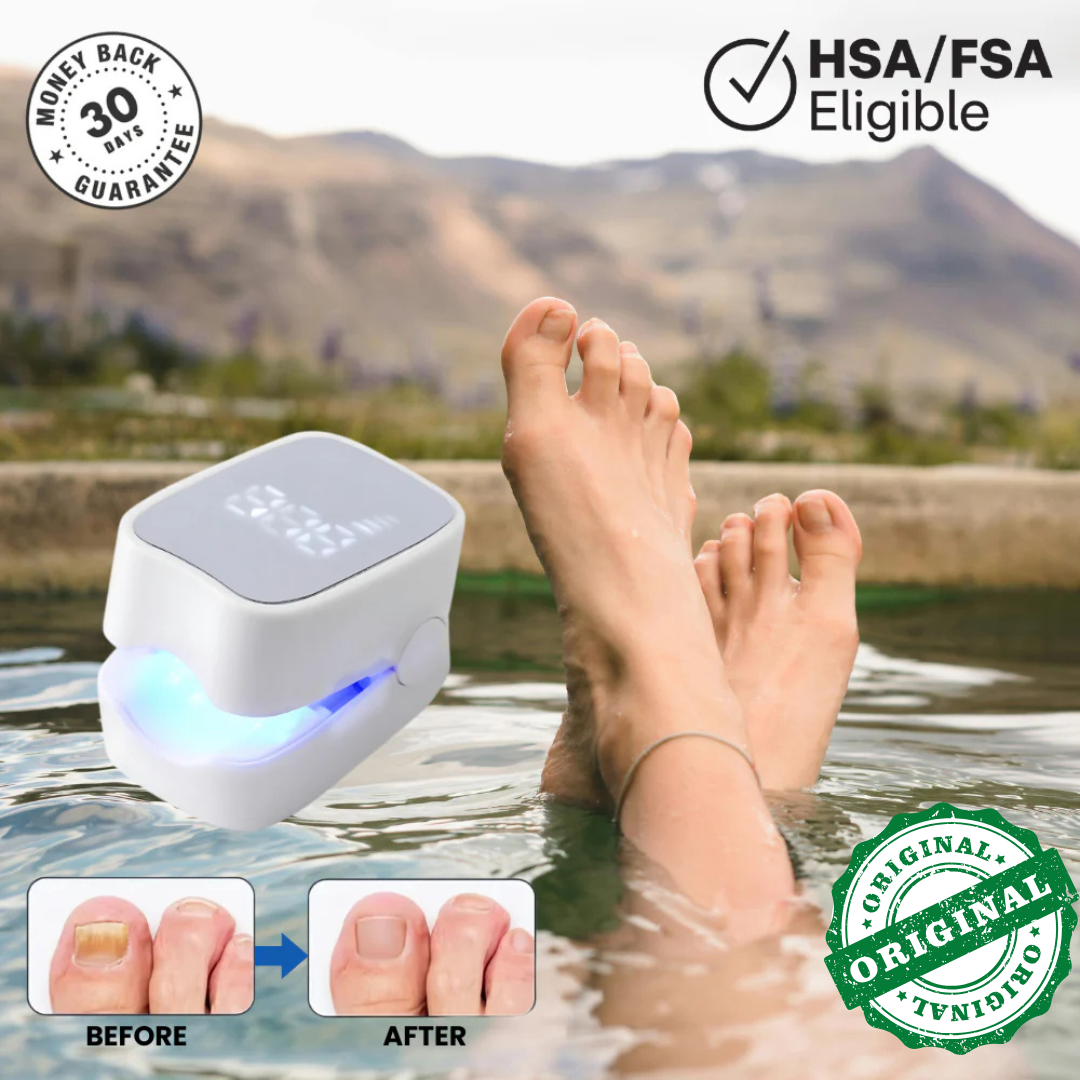 NailHeal Pro™ – Nail Fungus Treatment Device