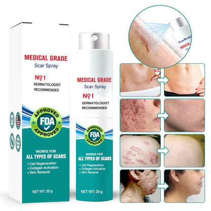 ❤️ Advanced Scar Spray For All Types of Scars - For example Acne Scars, Surgical Scars and Stretch Marks ⚡️⚡️⚡️Only 500 bottles left!